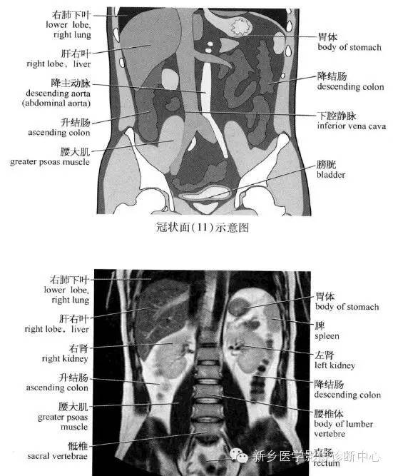 腹部冠状位解剖+详细标注