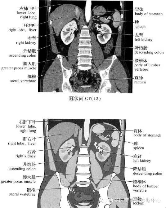 腹部冠状位解剖+详细标注