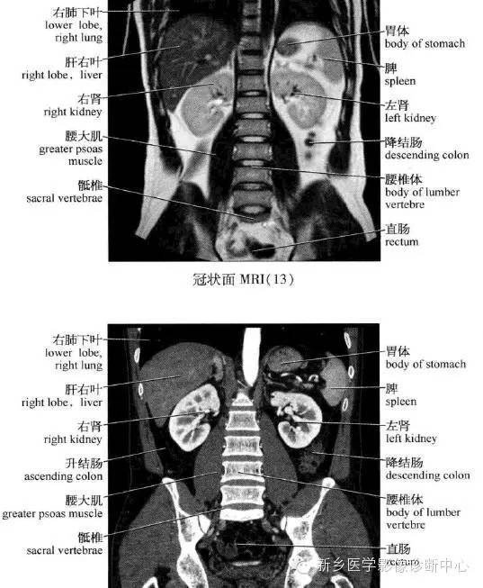 腹部冠状位解剖+详细标注