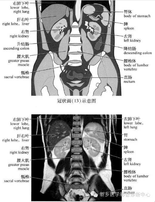 腹部冠状位解剖+详细标注