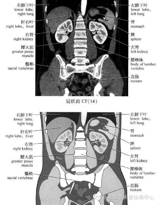 腹部冠状位解剖+详细标注