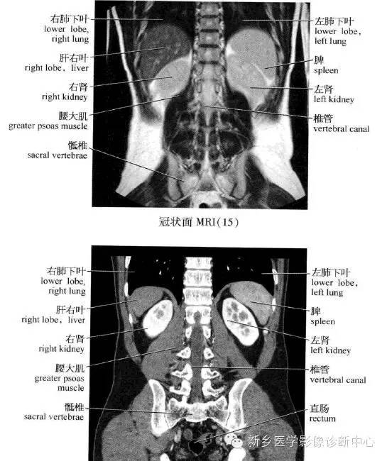 腹部冠状位解剖+详细标注