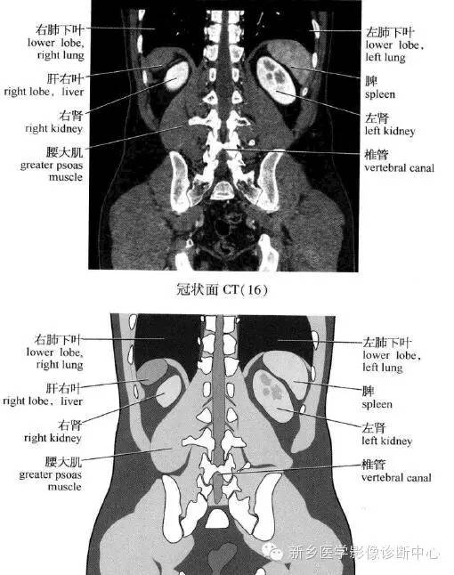 腹部冠状位解剖+详细标注