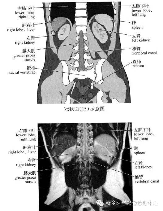 腹部冠状位解剖+详细标注