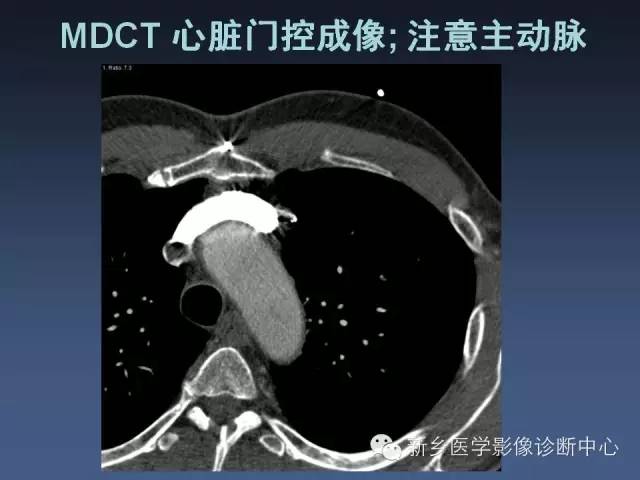 【PPT】多层螺旋CT（MDCT）在胸部外伤诊断中的应用