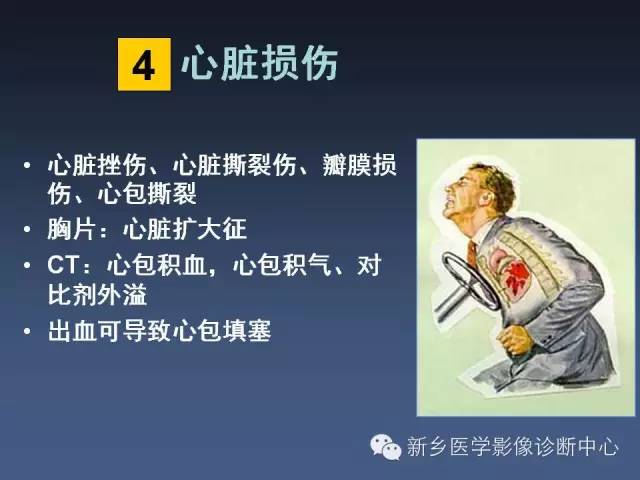 【PPT】多层螺旋CT（MDCT）在胸部外伤诊断中的应用