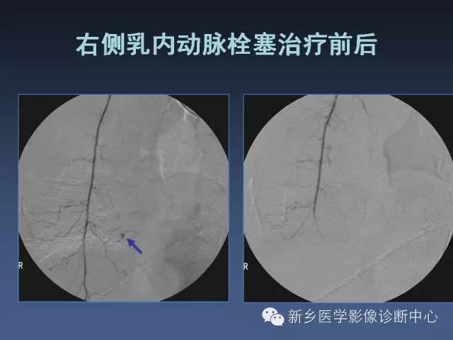 【PPT】多层螺旋CT（MDCT）在胸部外伤诊断中的应用