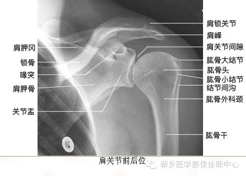全身常见部位X线详细解剖+标注