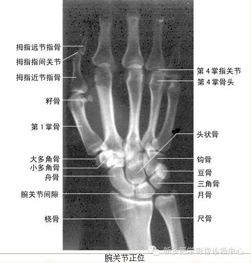 全身常见部位X线详细解剖+标注