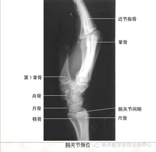 全身常见部位X线详细解剖+标注