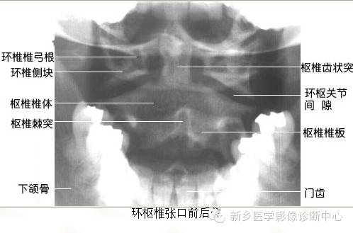 全身常见部位X线详细解剖+标注