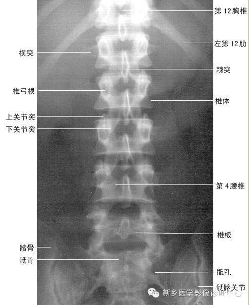 全身常见部位X线详细解剖+标注