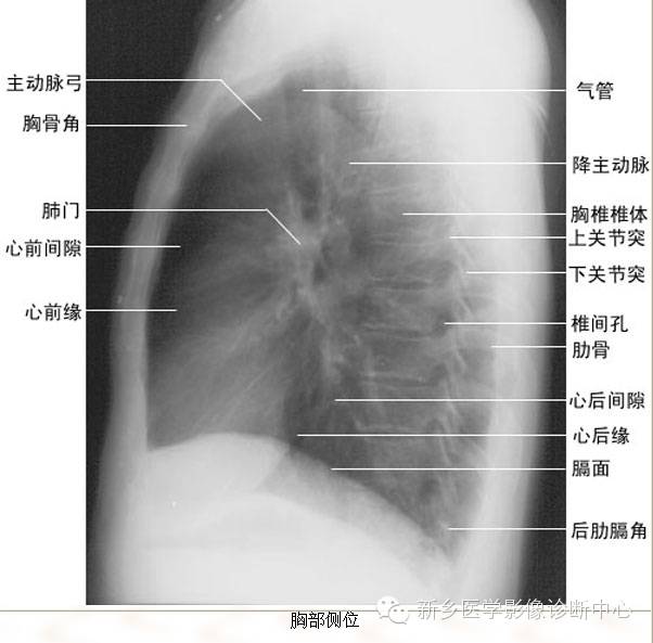 全身常见部位X线详细解剖+标注