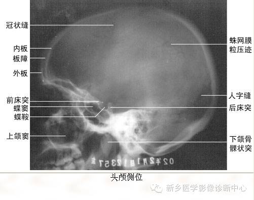 全身常见部位X线详细解剖+标注