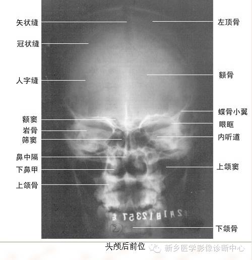 全身常见部位X线详细解剖+标注