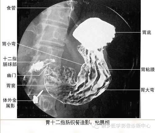 全身常见部位X线详细解剖+标注