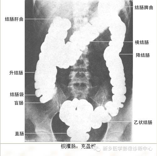 全身常见部位X线详细解剖+标注