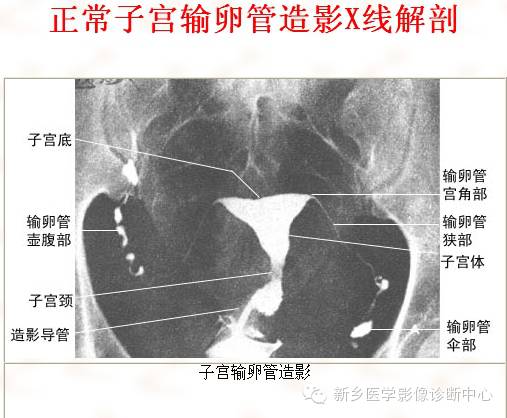 全身常见部位X线详细解剖+标注