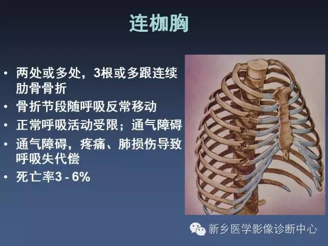 【PPT】多层螺旋CT（MDCT）在胸部外伤诊断中的应用