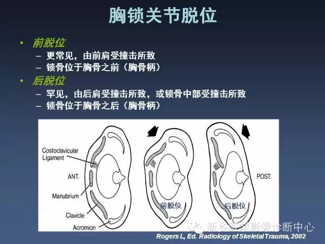 【PPT】多层螺旋CT（MDCT）在胸部外伤诊断中的应用