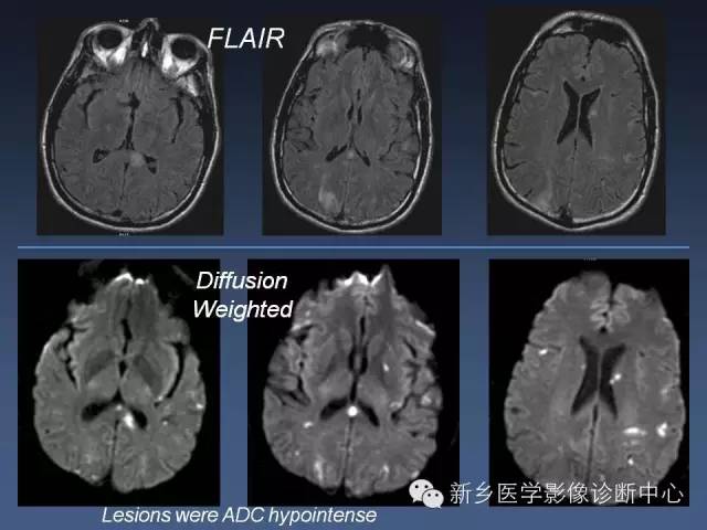 【PPT】多层螺旋CT（MDCT）在胸部外伤诊断中的应用