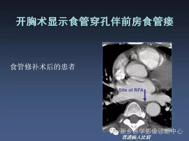 【PPT】多层螺旋CT（MDCT）在胸部外伤诊断中的应用