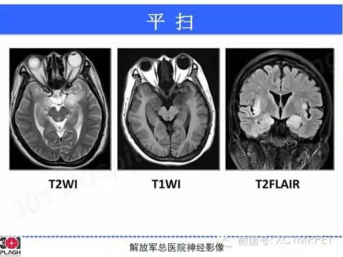 【病例】