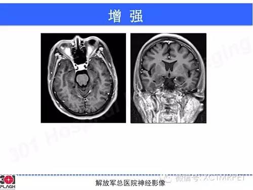【病例】