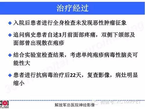 【病例】