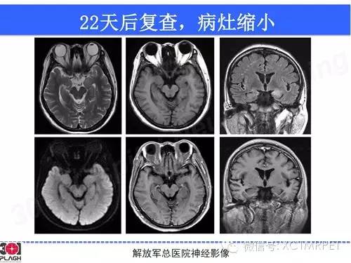 【病例】