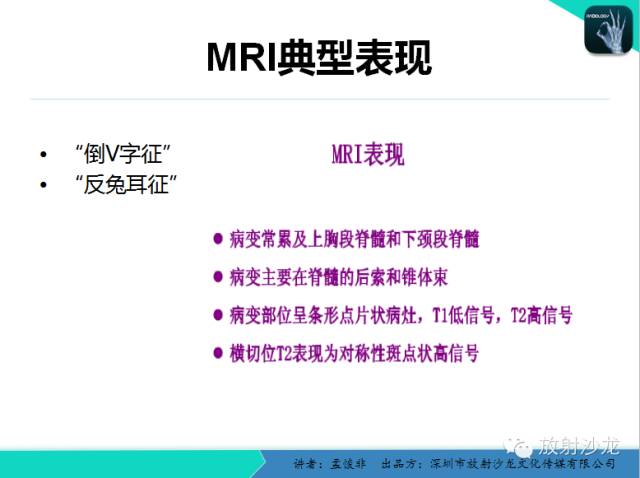 【PPT】脊髓亚急性联合变性