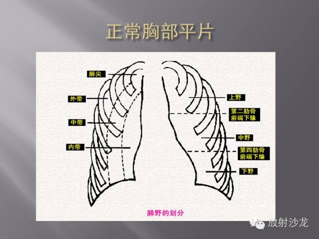 胸部正常X线、CT表现及常见病的诊断