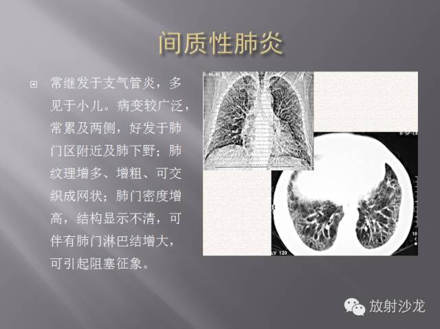 胸部正常X线、CT表现及常见病的诊断