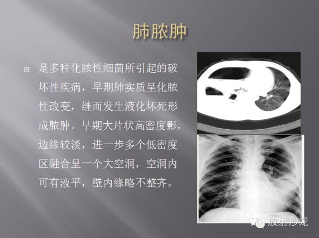 胸部正常X线、CT表现及常见病的诊断