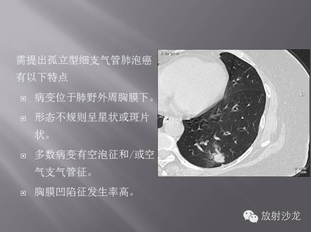 胸部正常X线、CT表现及常见病的诊断