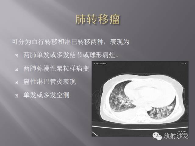 胸部正常X线、CT表现及常见病的诊断