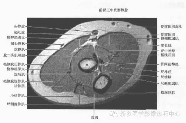 前臂精细解剖+详细标注