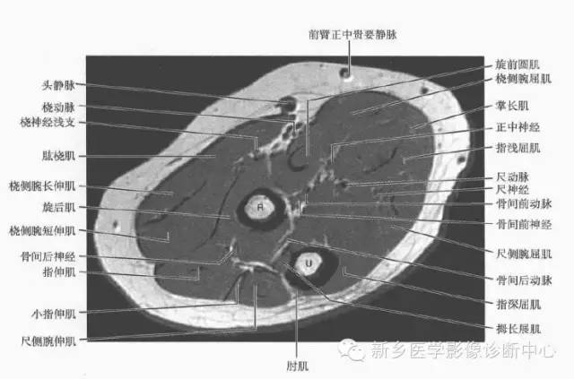 前臂精细解剖+详细标注
