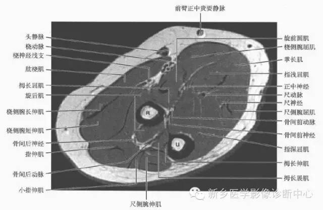 前臂精细解剖+详细标注