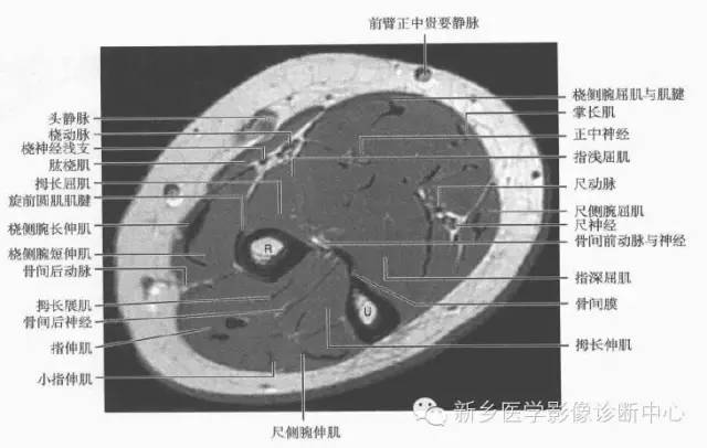 前臂精细解剖+详细标注