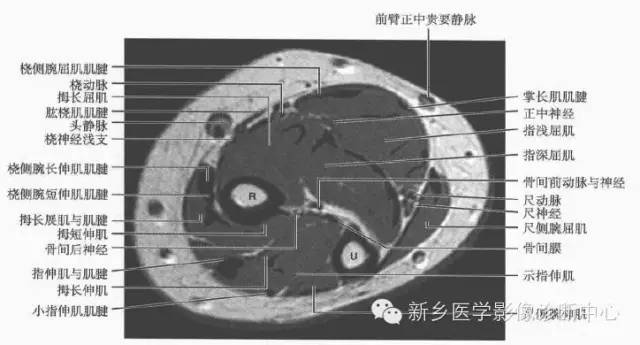 前臂精细解剖+详细标注