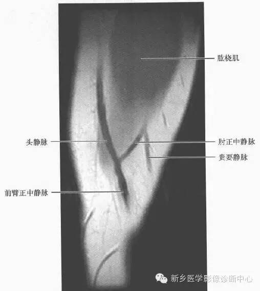 前臂精细解剖+详细标注