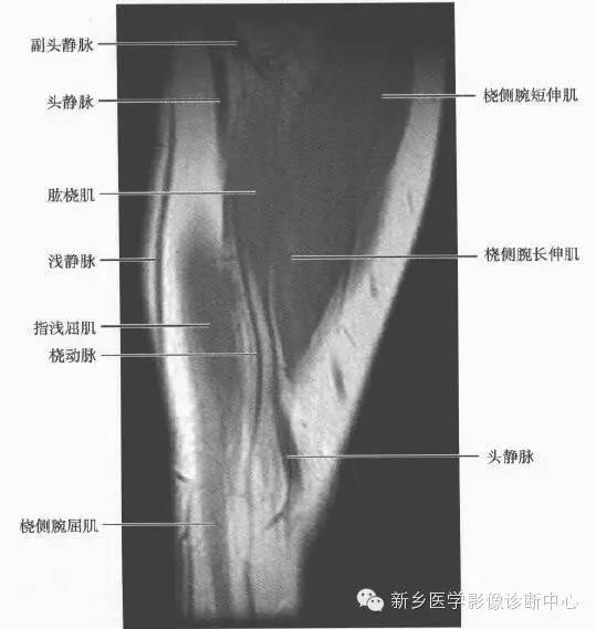 前臂精细解剖+详细标注