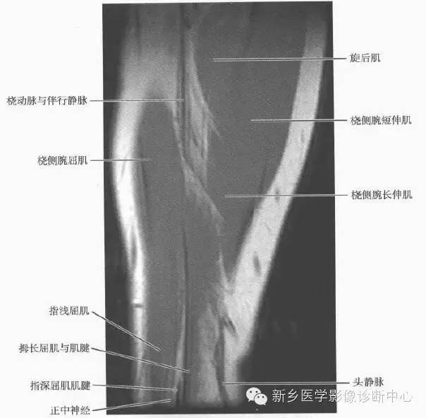 前臂精细解剖+详细标注