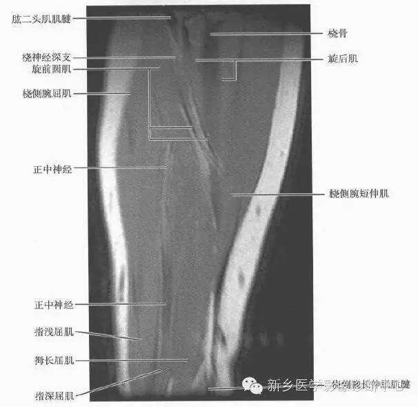 前臂精细解剖+详细标注