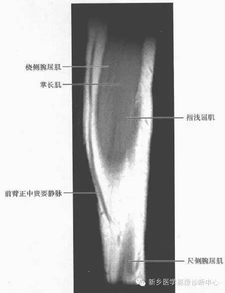 前臂精细解剖+详细标注