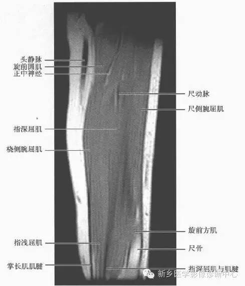 前臂精细解剖+详细标注