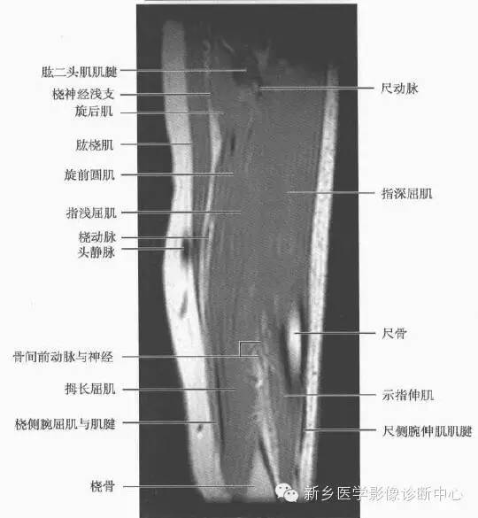 前臂精细解剖+详细标注