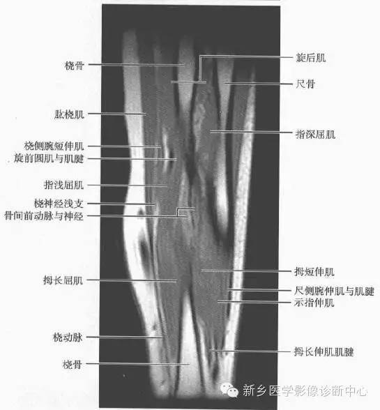 前臂精细解剖+详细标注