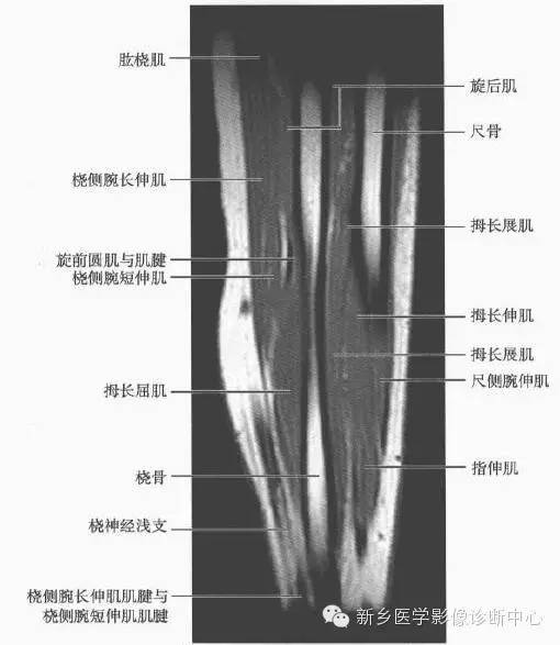 前臂精细解剖+详细标注